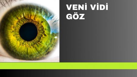 Venividigoz ile Görüş Kalitenizi Artırın